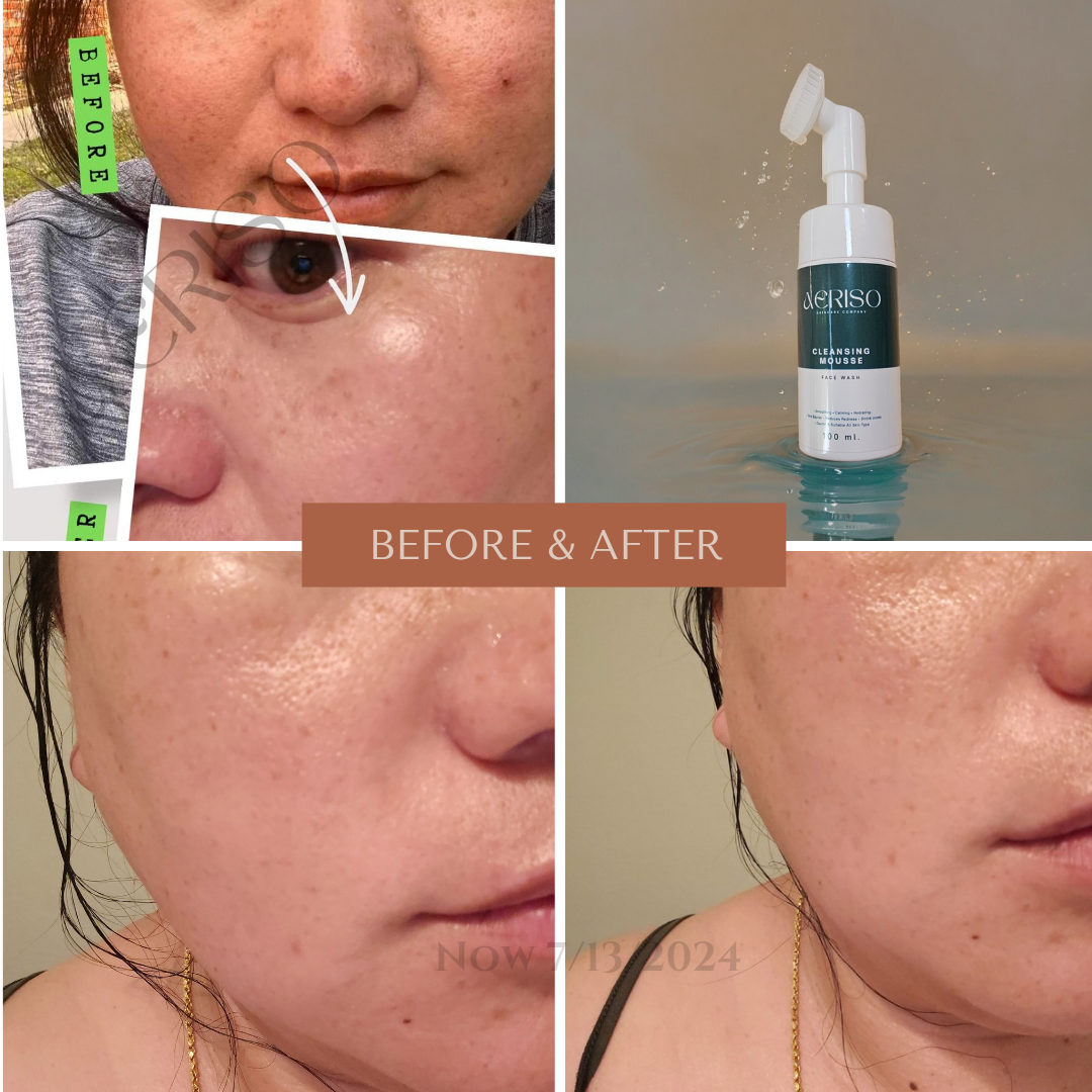 Aeriso Cleansing Mousse Foam Face Wash, 100mL